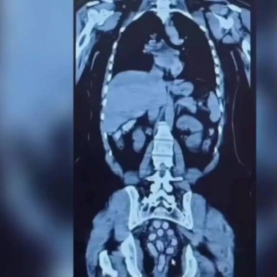 Midelerinde 1,5 kilo uyuşturucu çıkan 2 kadın tutuklandı